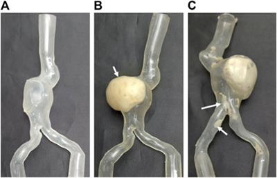 Prediction of guidewire-induced aortic deformations during EVAR: a finite element and in vitro study